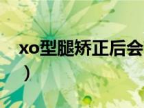 xo型腿矫正后会高几厘米（xo型腿怎么矫正）