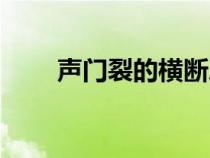 声门裂的横断层面上不出现（声门）