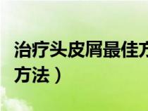 治疗头皮屑最佳方法有哪些（治疗头皮屑最佳方法）