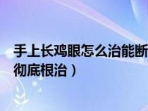 手上长鸡眼怎么治能断根最好用的方法（手上长鸡眼怎么能彻底根治）