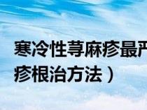 寒冷性荨麻疹最严重后果会怎样（寒冷性荨麻疹根治方法）