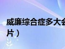 威廉综合症多大会说话（威廉综合症小精灵图片）