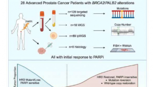 科学家可以预测前列腺癌患者对奥拉帕尼的反应时间